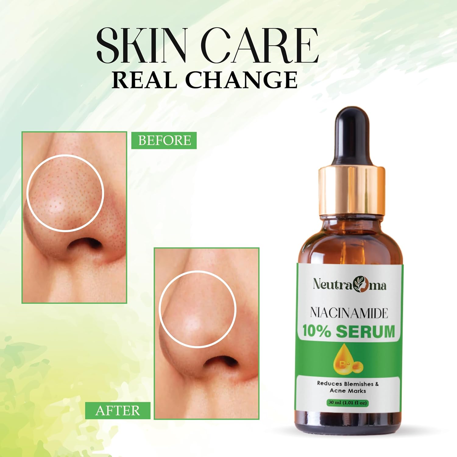 Niacinamide 10% Serum for Dark Spots, Acne Marks & Uneven Skin Tone | Vitamin B3 Brightening Face Serum | Oil Control, Pore Minimizer | 30ml Paraben-Free, Unscented