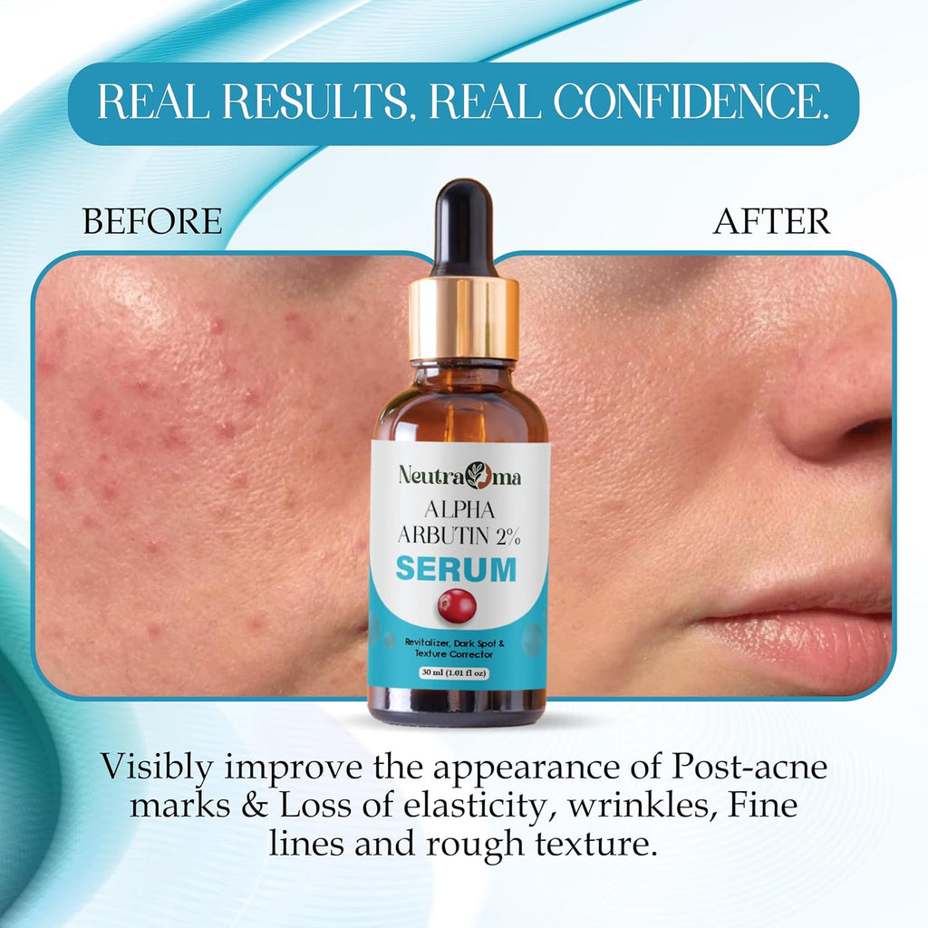 Alpha Arbutin 2% Serum for Dark Spots, Pigmentation & Uneven Skin Tone | Brightening Face Serum with Texture Corrector | Fast Absorbing, Lightweight Formula | 30ml