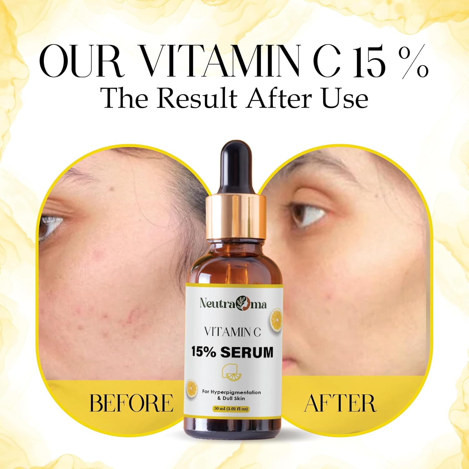 Vitamin C 15% Glow Serum | Targets Dark Spots, Pigmentation & Sun Damage | Radiance Enhancing Facial Treatment | 30ml