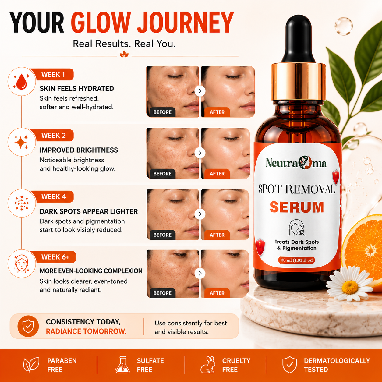 Neutraroma Spot Removal Serum – Dark Spot & Pigmentation Correcting Facial Serum for Brighter, Even-Toned Skin, 30ml Dropper Bottle