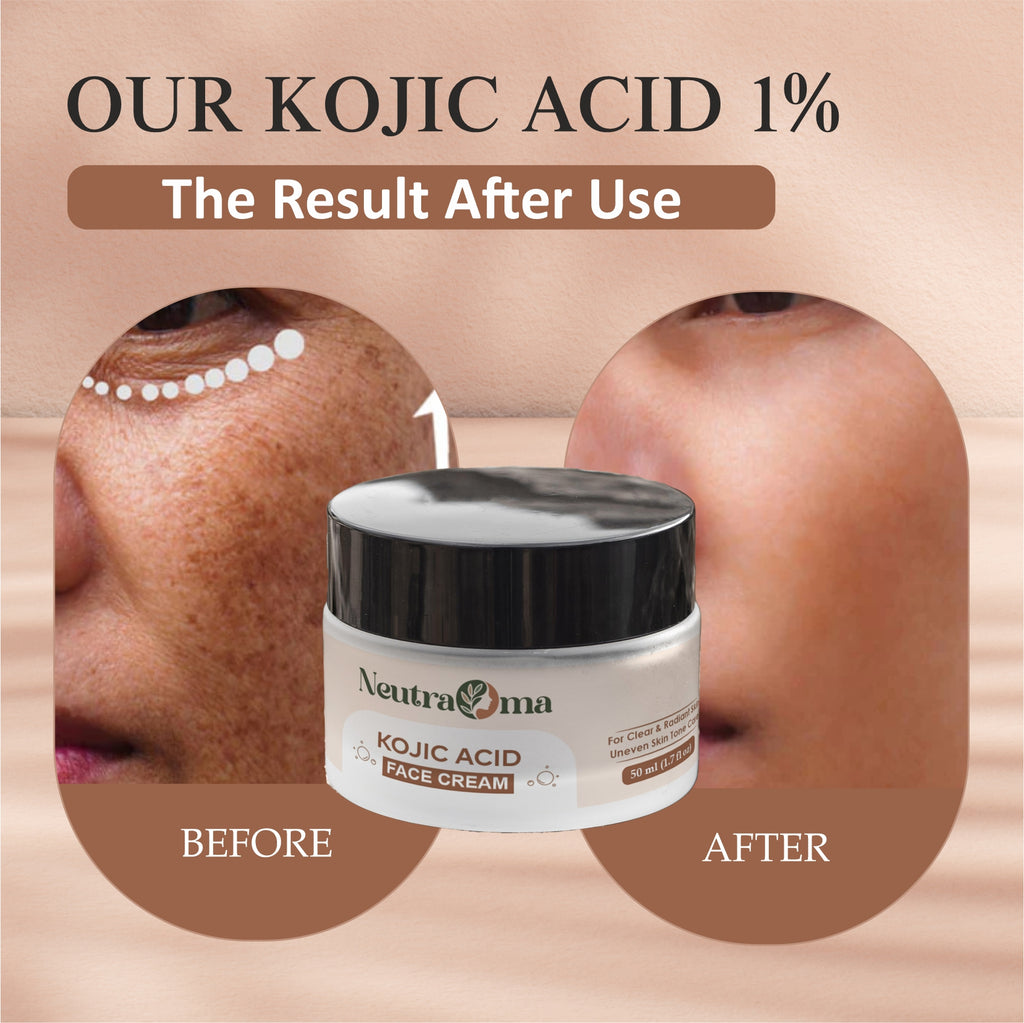 Kojic Acid Cream – Fade Dark Spots, Brighten Skin & Even Tone | Advanced Pigmentation Repair Face Cream | Glowing Skin Formula