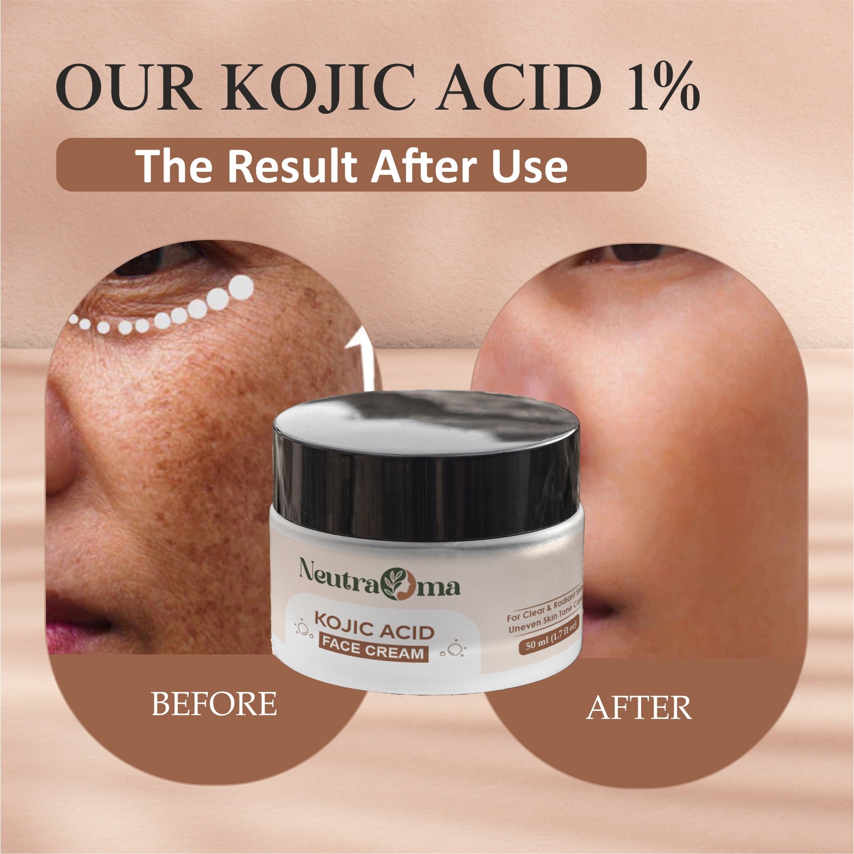 Kojic Acid Cream – Fade Dark Spots, Brighten Skin & Even Tone | Advanced Pigmentation Repair Face Cream | Glowing Skin Formula